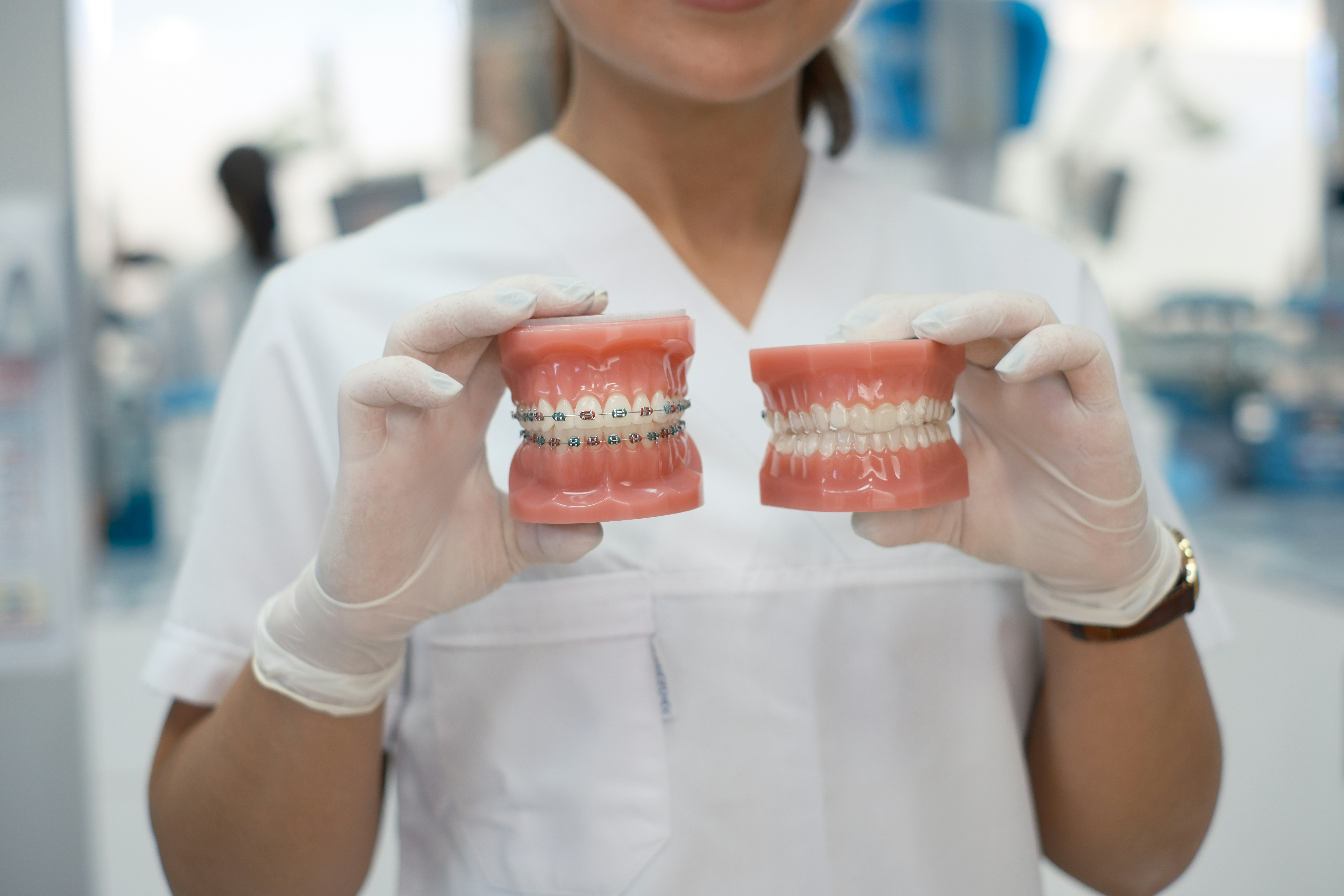 Professionnelle de santé présentant deux modèles de dents avec et sans appareil, illustrant un traitement d’orthodontie à Strasbourg en cabinet dentaire.